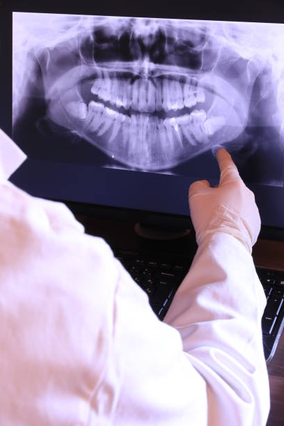 Best Emergency Tooth Extraction  in Shenandoah, VA
