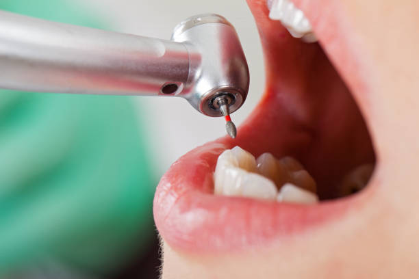 Best Urgent Tooth Repair  in Shenandoah, VA